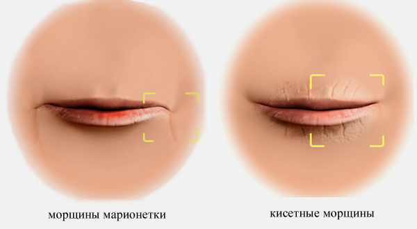 Рецепт крема от морщин