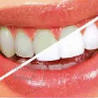 Отбеливающая Silika White 30 гр