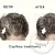 Capillary treatments, 5 мл артикул TM20041601