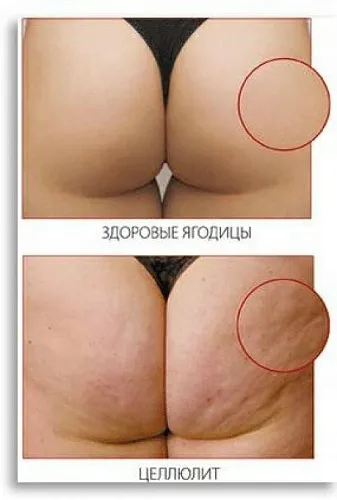 Pepti-slim 500 ml cosmetic ingredient Mylo Opt